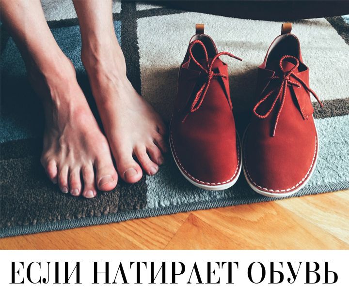 Что делать, если натирает обувь? Эффективные советы — блог kormstroytorg.ru
